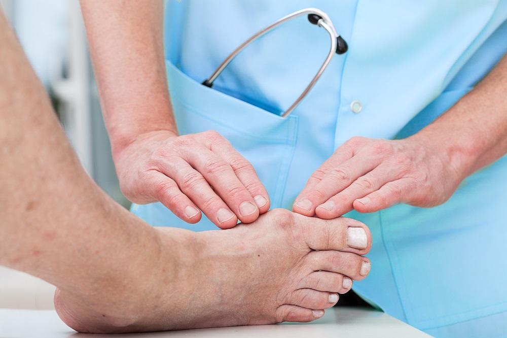 The doctor often recommends surgery to treat hallux valgus