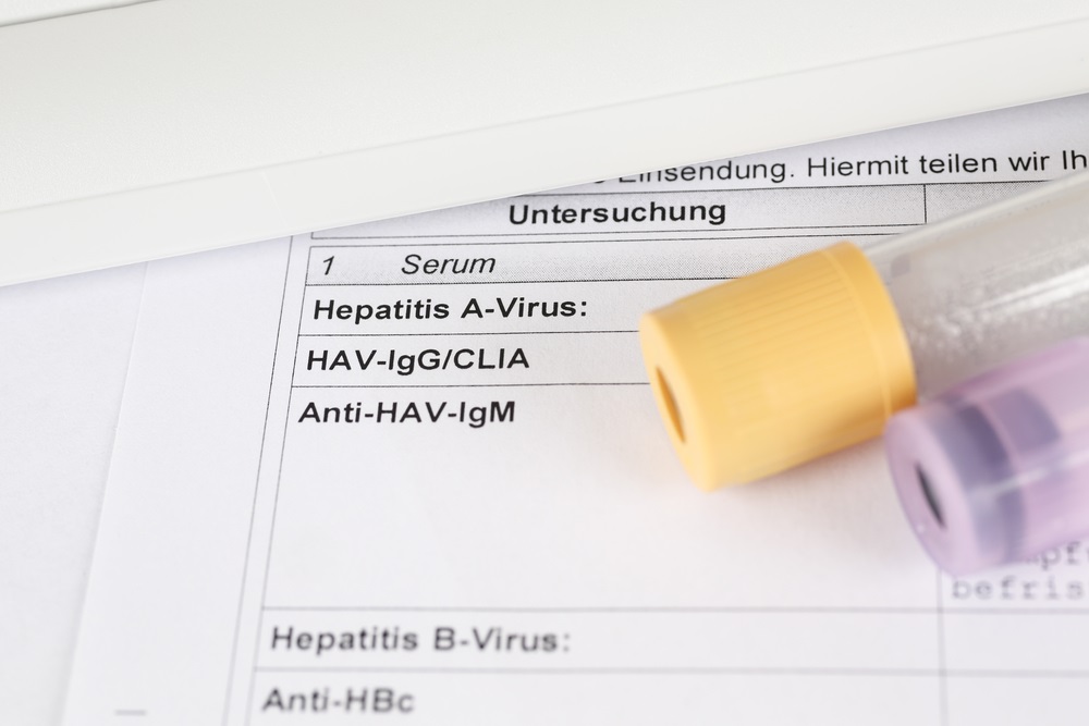 Hepatitis A wird durch das gleichnamige Hepatitis A-Virus verursacht.