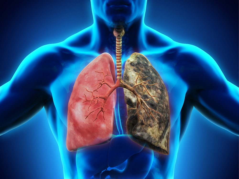 Healthy lung and smoker's lung